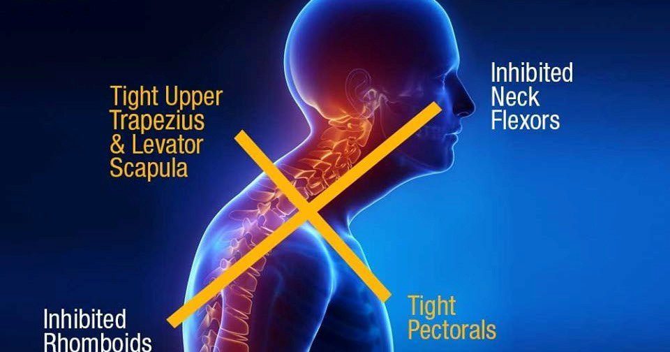 poor corporate posture