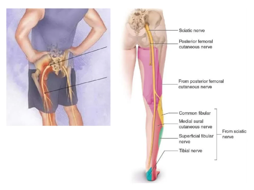 sciatic nerve physiotherapy sciatic nerve physiotherapy